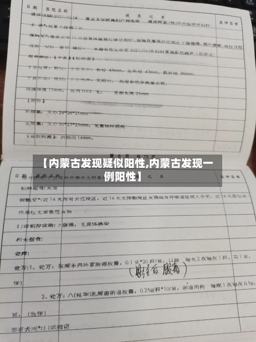 【内蒙古发现疑似阳性,内蒙古发现一例阳性】-第2张图片